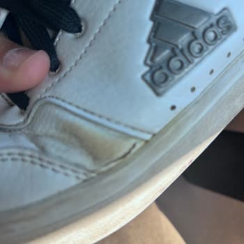 Adidas Ayakkabısında Erken Çatlama Ve Sararma, İade İstiyorum