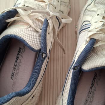 Skechers Ayakkabılarda Kısa Sürede Deformasyon Ve Garanti Süresi Dışı Red