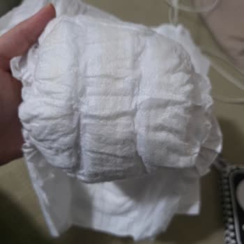 Molfix Bebek Bezlerinde Kullanılmış Görünen Ürün Şikayeti