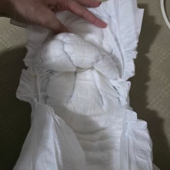 Molfix Bebek Bezlerinde Kullanılmış Görünen Ürün Şikayeti