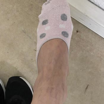 Dar Ve Sert Bot Ayak Yarası Yaptı, İade Talebine Yanıt Alınamadı