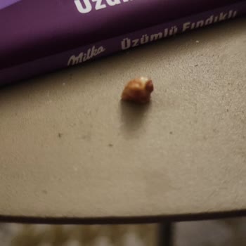 Milka Çikolatasındaki Yabancı Cisim Diş Hasarına Neden Oldu