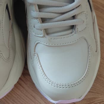 Dakota Ayakkabısının Kısa Sürede Ayağa Vurması Ve Sol Tekin Deforme Olması