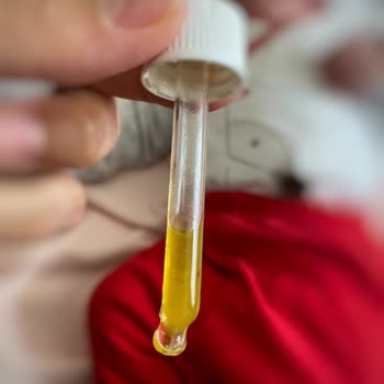 Nurse Harvey’s Şişesinden Kıl Çıktı: Bebeğim İçin Hayati Tehlike