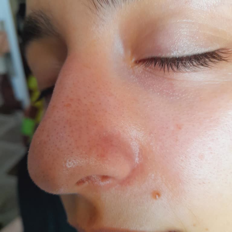 Ciltte Yanma Ve Kızarıklık, Danışman Çözüm Sunmadı