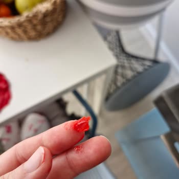 Çocuk Oyun Hamurunda Keskin Parçalar Çıktı Kızım Avucuna Battı