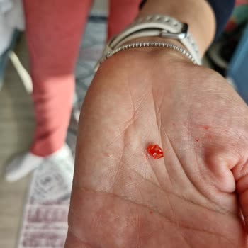 Çocuk Oyun Hamurunda Keskin Parçalar Çıktı Kızım Avucuna Battı