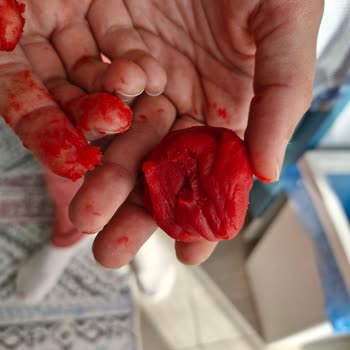 Çocuk Oyun Hamurunda Keskin Parçalar Çıktı Kızım Avucuna Battı