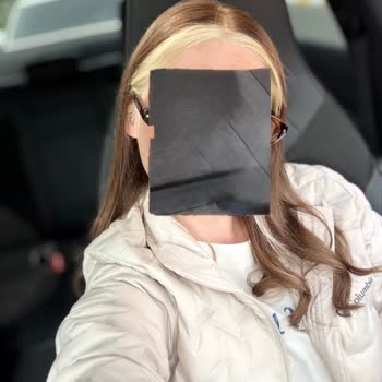 Staff Hair Studio Saçımı Mahvetti Ve Yüzümü Yaktı