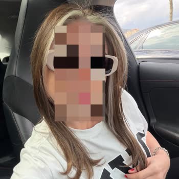 Staff Hair Studio Saçımı Mahvetti Ve Yüzümü Yaktı