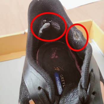 Greyder Spor Ayakkabısında Erken Deformasyon Ve Mağaza Tarafından Kullanıcı Hatası İddiası