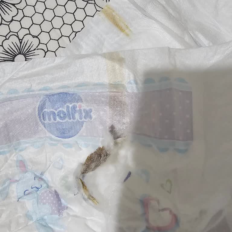 Molfix Bebek Bezlerinde Leke Ve Yapışkan Maddeden Hijyen Riski