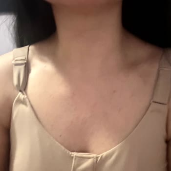 Marks&Spencer Sutyeni 1 Ayda Sol Tarafta Kayma Ve Değişim Talebi