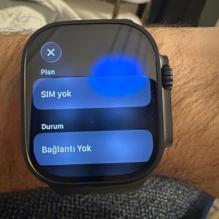 Apple Watch LTE Bağlantısı Çalışmıyor, Turkcell Paketi İptali Ve Çözüm Talebi