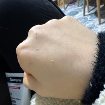 Neutrogena El Kremi Kullanım Sonrası Ellerimde İnce Soyulma