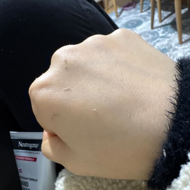 Neutrogena El Kremi Kullanım Sonrası Ellerimde İnce Soyulma