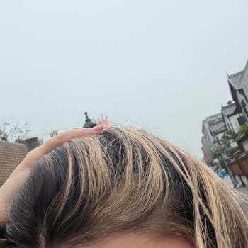 İki Defa Hatalı Saç Boyası Ve 7000 TL İade Talebi