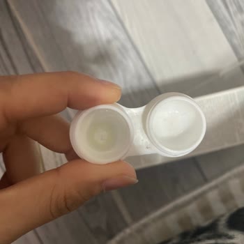 Siparişte Tek Lens, Diğer Lens Yok: Acil Destek Talebi