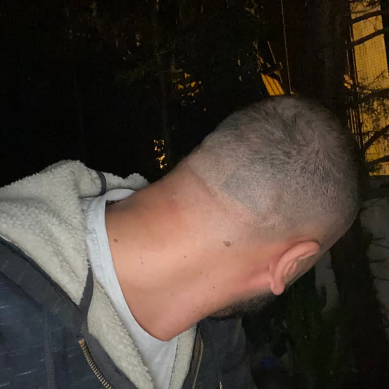 Saç Ekimi Sonuçsuz Ve Kötü Görünüm İade Talebi