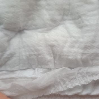 Molfix Bebek Bezinde Üretim Hatası: Sert Cisim