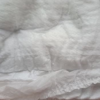 Molfix Bebek Bezinde Üretim Hatası: Sert Cisim