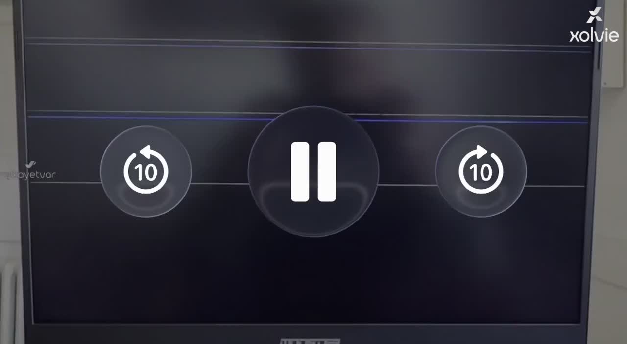 I Face Monster Tulpar Laptop Issues After Multiple Replacements video cover
