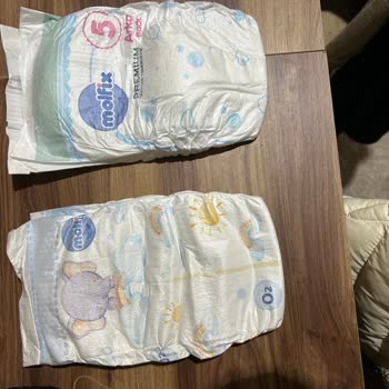 Molfix Premium Smart Fit Bezinde Hava Açığı Yok, Bebekte Şiddetli Pişik