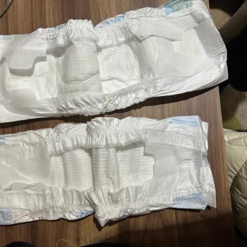 Molfix Premium Smart Fit Bezinde Hava Açığı Yok, Bebekte Şiddetli Pişik