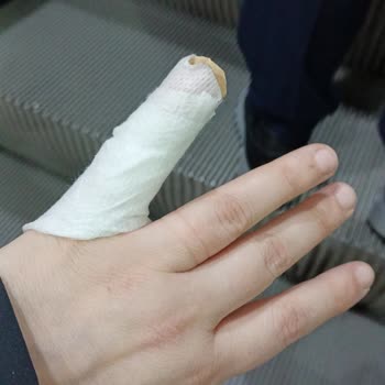 BM 6 Otobüs Şoförünün Hızını Azaltmaması Nedeniyle Düşme Ve Yaralanma