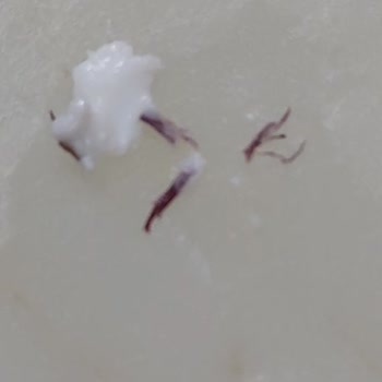 Ünal Peynirde Hamam Böceği Parçaları Ve Müşteri Hizmetlerinden Sessiz Kalınması