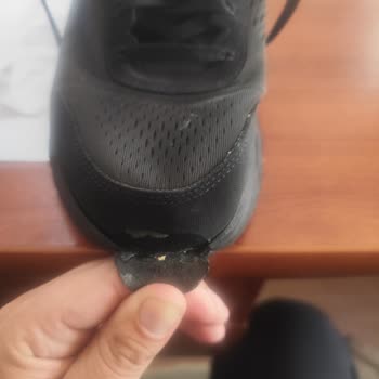 Skechers Ayakkabımda Erken Aşırı Aşınma Ve Deformasyon Üretim Hatası Olmadığı Söylendi