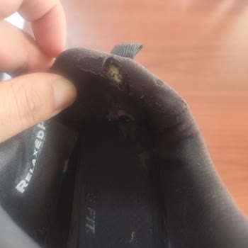 Skechers Ayakkabımda Erken Aşırı Aşınma Ve Deformasyon Üretim Hatası Olmadığı Söylendi