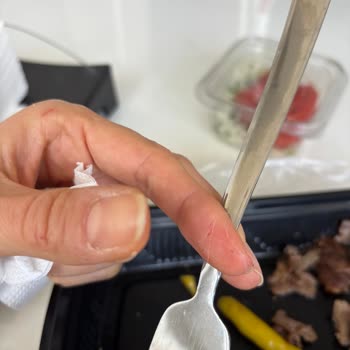 Hijyen Sorunu Dönerde Yabancı Madde Ve Eksik İade