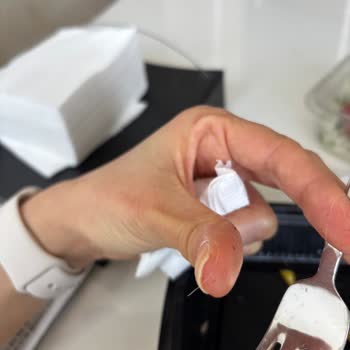 Dönerci Onur (İzmir) Kıl/tüy Benzeri Yabancı Bir Madde Çıktı