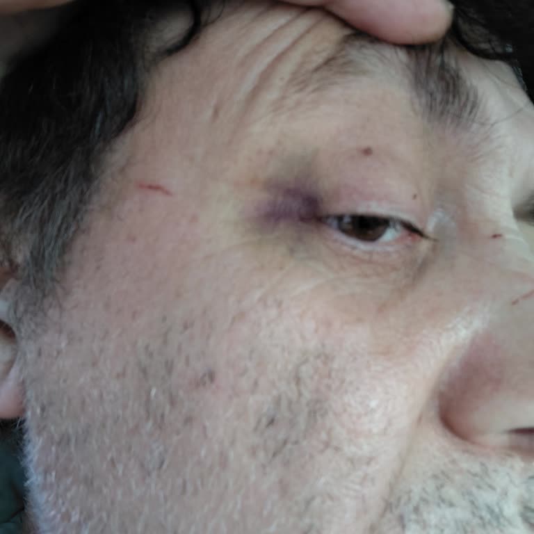 Nef Estetik’te Yanıltıcı Kampanyalar, Zorlayıcı Ödeme ve Psikolojik Baskı Sonucu 96 Bin TL Kayıp