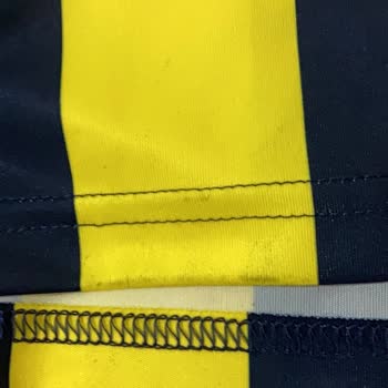 Formada Lekeler Ve Değişim Talebi