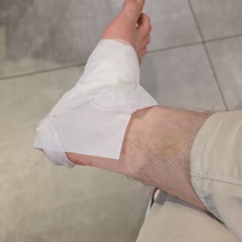 Adidas Mağazasında Alarm İğnesi Yaralanmaya Yol Açtı