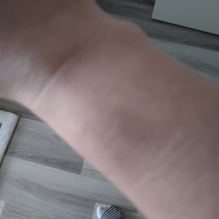 Huawei Gt 5 Akıllı Saatte Onay Almadan Parça Değişimi Ve Ayıplı Mal İddiası