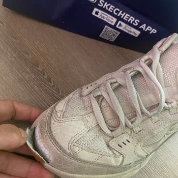 Garanti Süresi Bitmeden Açılan Skechers Ayakkabı İçin Çözüm Talebi