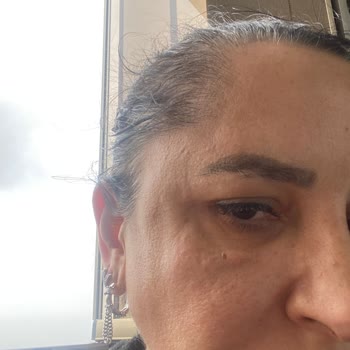 Yanıltıcı Ödeme Ve Estetik İşlem Sonrası Sağlık Sorunları Nedeniyle 111.000 TL İadesi Talebi