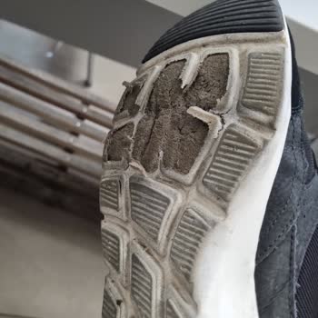 Skechers Ayakkabısının Tabanı 7 Ayda Dökülerek Kullanılamaz Hale Geldi