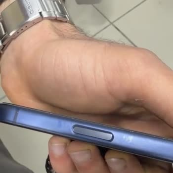 Kamera Düğmesi Ve Hoparlör Bölgesindeki Renk Değişimi Ve Beyaz Noktalar: Ücretsiz Değişim Talebi