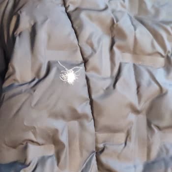 Columbia Delta Ridge Erkek Montunda Yoğun Tüylenme Ve Değişim Talebi