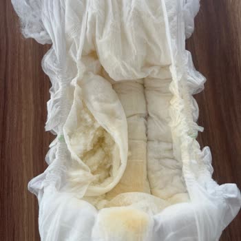 Kalitesiz Bebek Bezinde Yırtılma Ve Açık Paket Nedeniyle İade Reddi