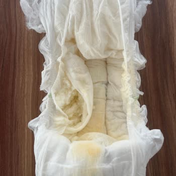 Kalitesiz Bebek Bezinde Yırtılma Ve Açık Paket Nedeniyle İade Reddi