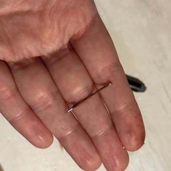 Dudak Kaleminde Gizli İğne: Hijyen Ve Güvenlik Tehlikesi