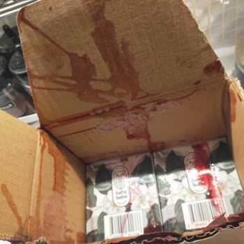 Açık Kapaklı Ürün Hijyen Sorunu Ve Tam İade Talebi