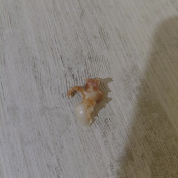 Beysos Döner'de Dürüme Kemik Parçası Kaçması Ve Yetersiz Çözüm Talebi