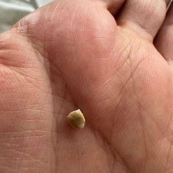 West Falafel Ürününde Taş Bulunması Diş Sağlığını Tehdit Ediyor