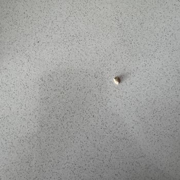 West Falafel Ürününde Taş Bulunması Diş Sağlığını Tehdit Ediyor